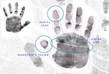 THE MOST CHALLENGING HAND: Simian Lines, Murderer’s Thumbs & Radial loops