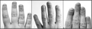 Domany et al 2018 nails and joints