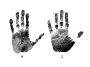 Digit ratio comparison low and high